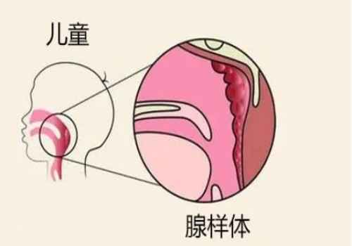 杭州正规代怀：﻿移植失败后快速恢复卵巢方法分享，请记住了